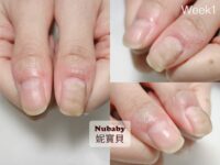 拇指指甲-波浪 變形 凹凸 橫豎紋路 黑甲 指甲矯正