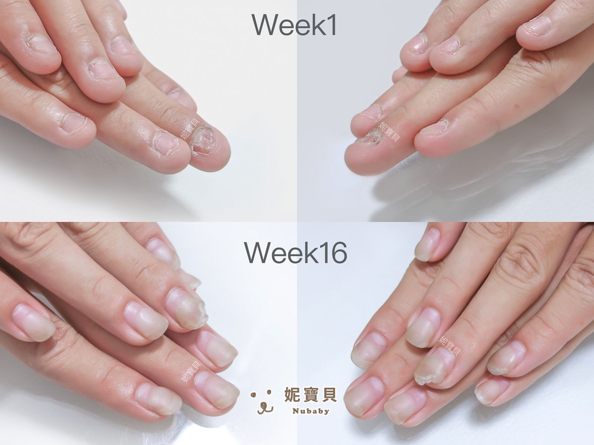 男大生 從沒指甲到有指甲