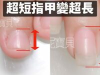 超短指甲 甲床變長 宜蘭高中生養甲